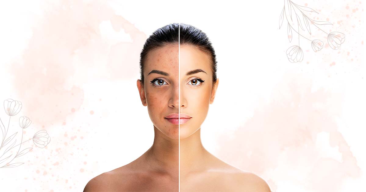Skincare