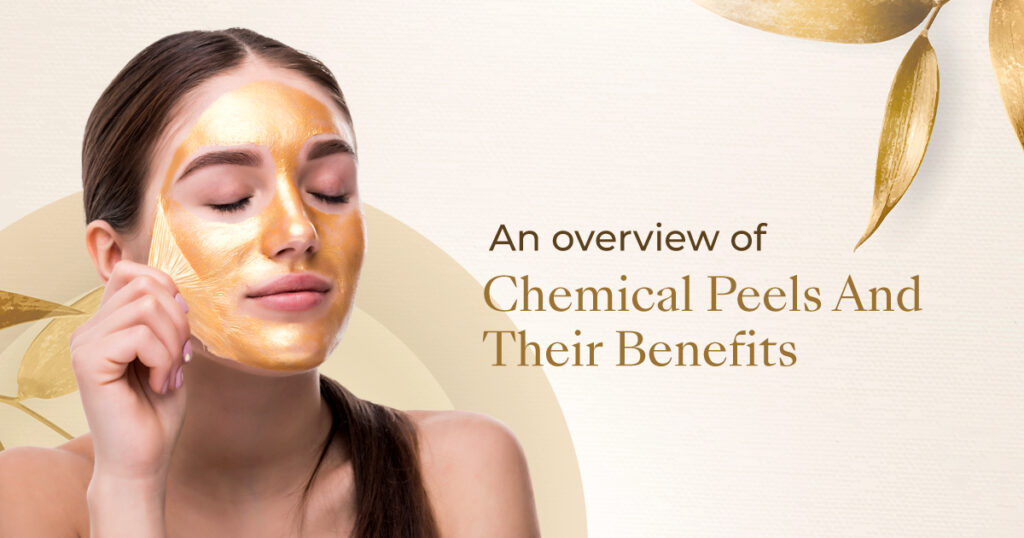 An overview of chemical peels and their benefits!